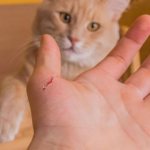 Чем опасен укус кошки для человека