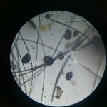 Чесоточные клещи под микроскопом