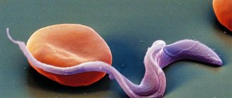 Chronic toxoplasmosis