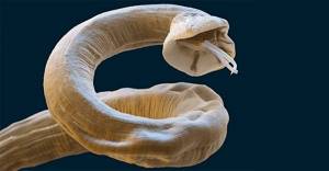 Как выглядят эндопаразиты черви-гельминты
