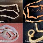 Tapeworms (cestodes)