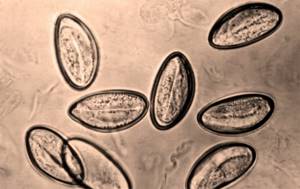 Яйца глистов гельминтов фото под микроскопом